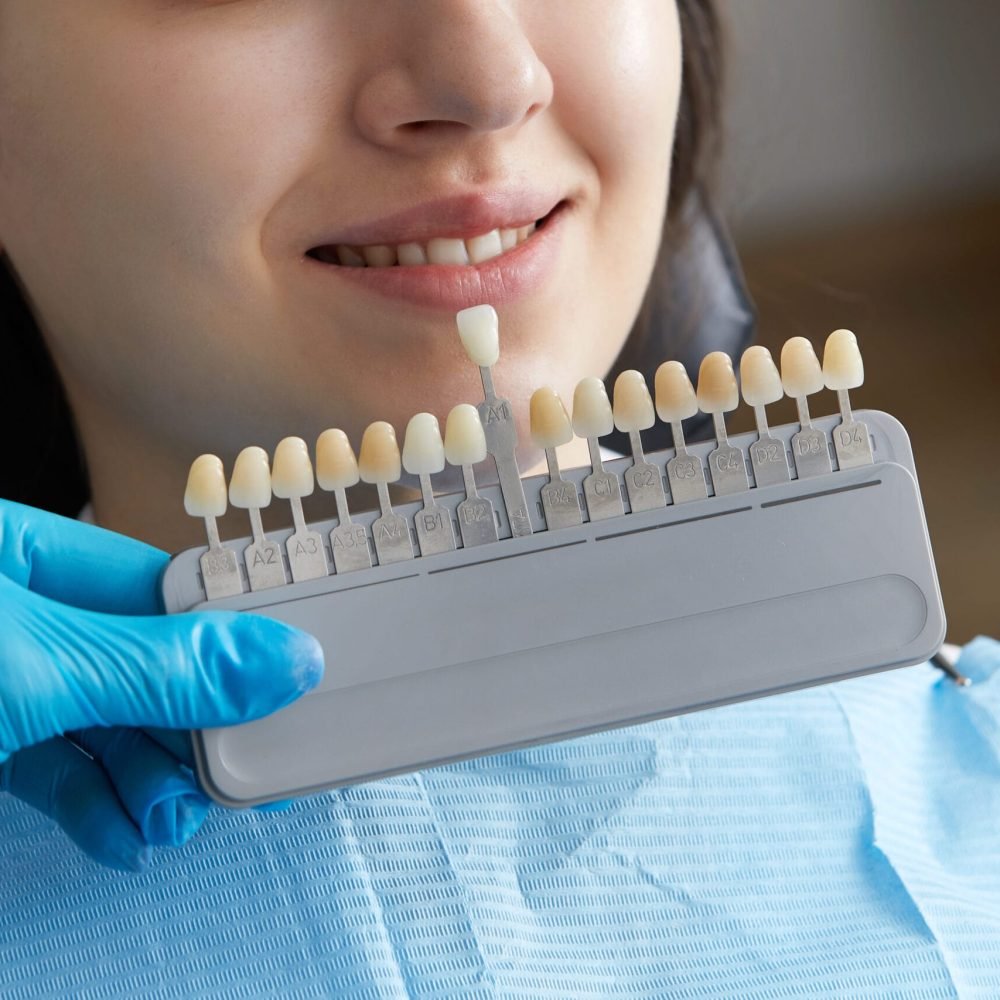 Dentist choosing color of tooth enamel for patient. Dentist applying sample from tooth enamel scale to caucasian female patient teeth