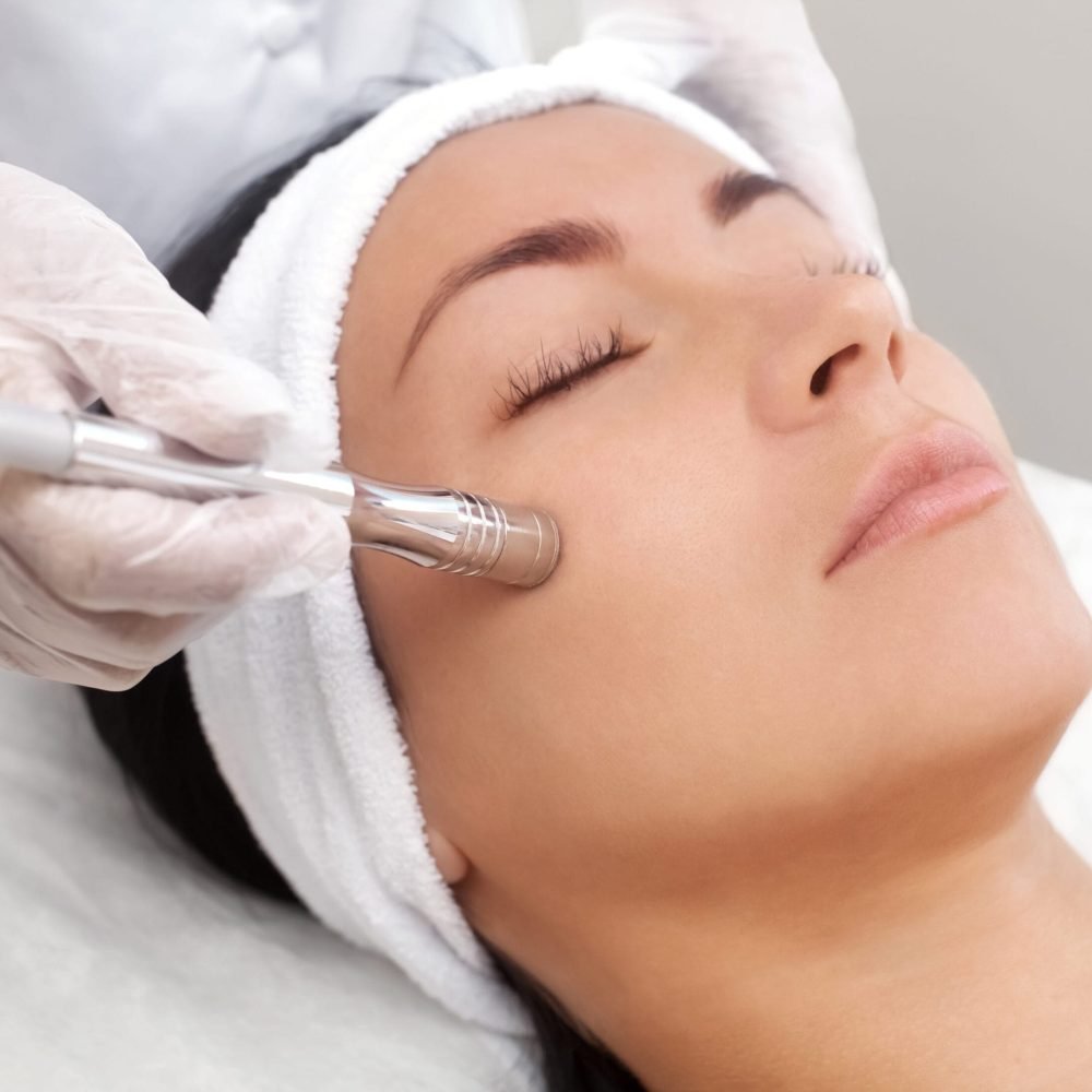 microdermabrasion